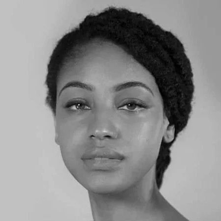 Dark Skin Women with Dermal Filler in Lips from Cosmetic Clinic in Brisbane looking