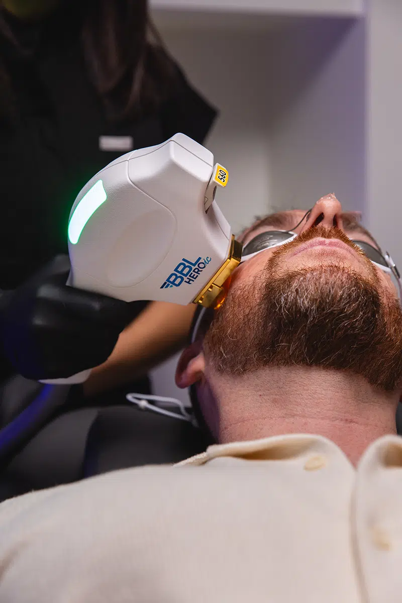 BBL HEROic® BroadBand Light treatment in progress at Eleventh Heaven, Teneriffe Brisbane QLD.