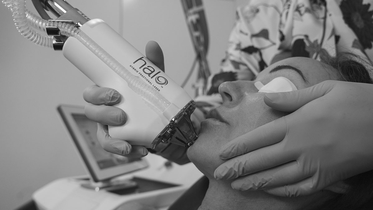 Women getting Halo Laser Treatment on Face in Brisbane Cosmetic Clinic