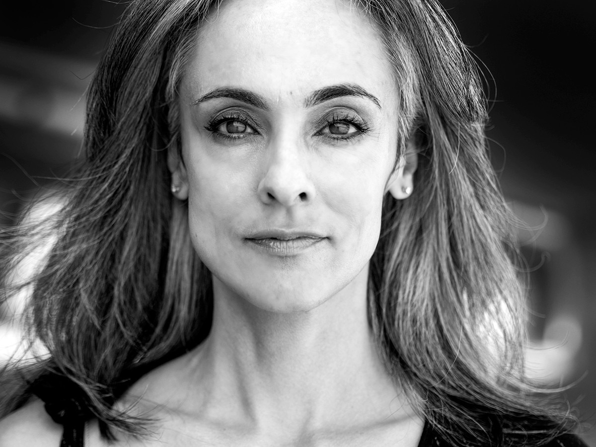 Marionette Filler in Brisbane, Lip Filler in Brisbane, Lip Augmentation in Brisbane, belotero brisbane, juvederm brisbane, stylage brisbane, radiesse brisbane, teosyal brisbane, dermal filler brisbane, restylane brisbane