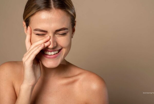 How to Treat Acne Scarring with Acne Scarring Laser Treatments