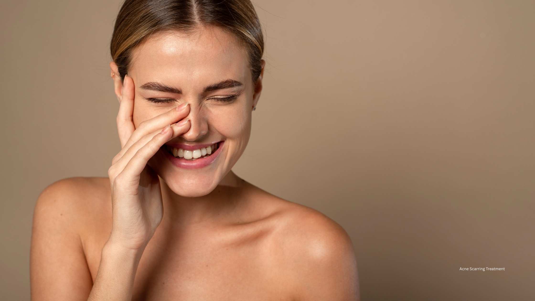 How to get rid of Acne Scars FAST | Acne Scarring Laser Treatment in Brisbane