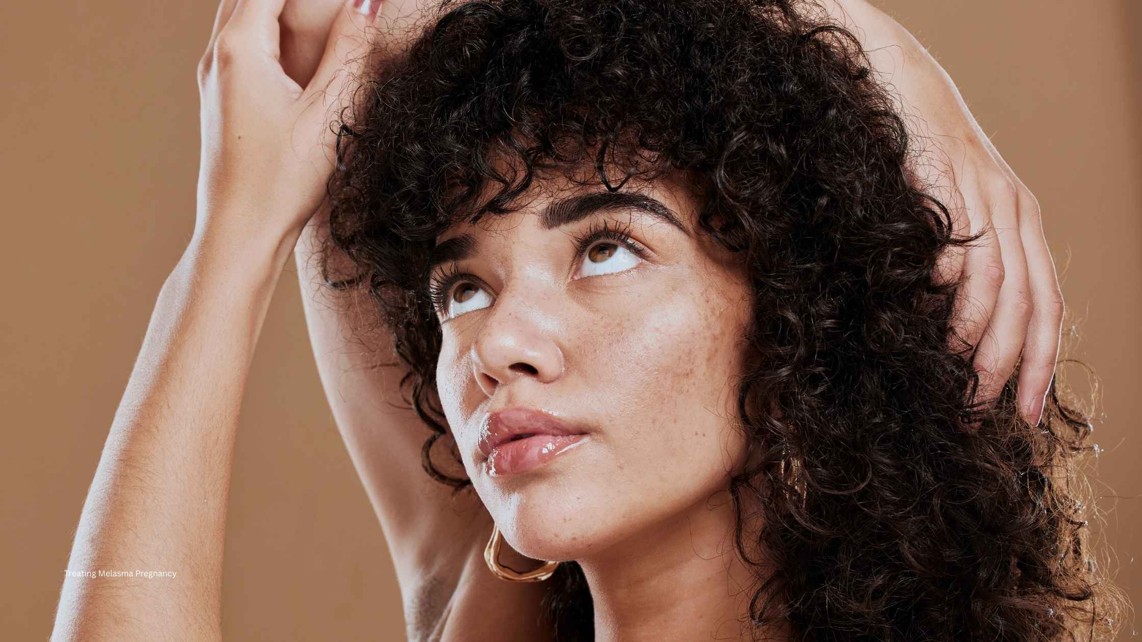 Melasma and Pregnancy | A Gentle Treatment Guide for Mums-to-Be